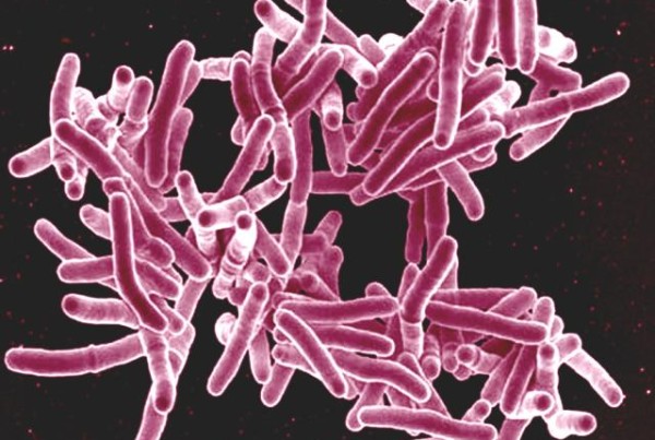 Experts Unsure Who is Responsible for the Latest Border Tuberculosis Scare