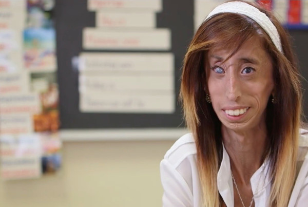 What Makes Someone Beautiful? Lizzie Velasquez Says ‘You Don’t Have to Look Like Everybody Else’