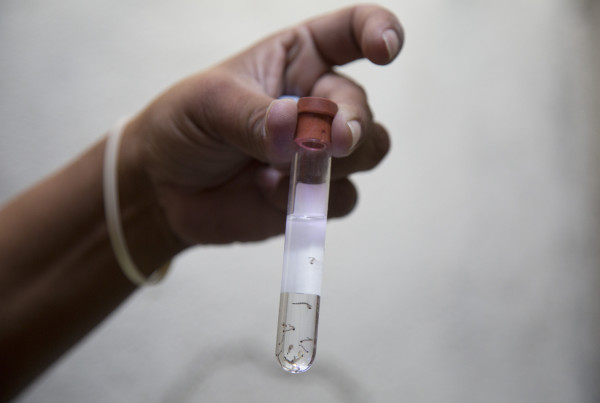 Baylor Launches $1 Million Zika Study To Understand Immune Response