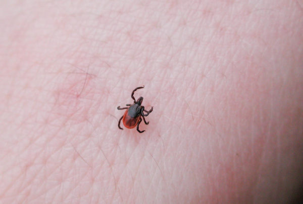 Tips For Ticks: How To Remain Bite-Free This Summer