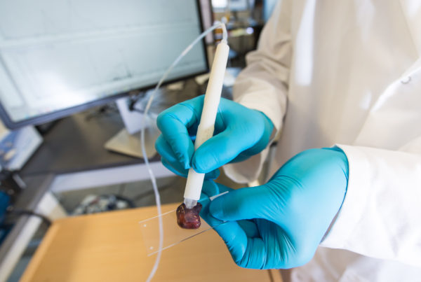 This New Pen Can Distinguish Between Healthy and Cancerous Tissue