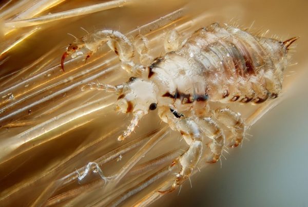 What Are The Facts Of Lice?