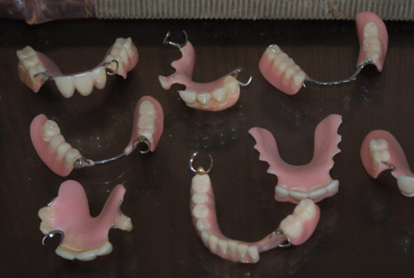 In Texas State Prisons, Dentures Are Rarely Deemed ‘Medically Necessary’
