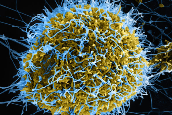 Using A ‘Decoy’ Method, The New Ebola Vaccine Could Help Contain Outbreaks
