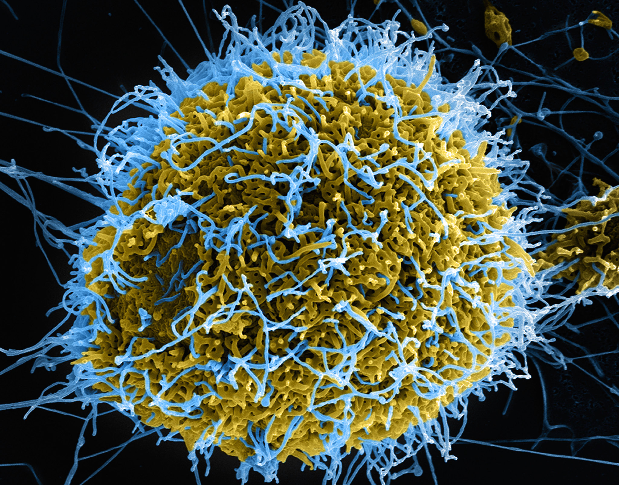 Using A 'Decoy' Method, The New Ebola Vaccine Could Help Contain Outbreaks - Texas Standard