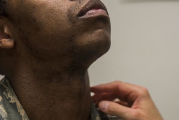 A Skin Condition Makes It Hard For Some Black Men To Shave — And Get Ahead In The Military