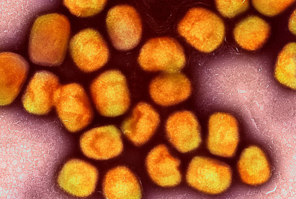a magnified view of the monkeypx virus