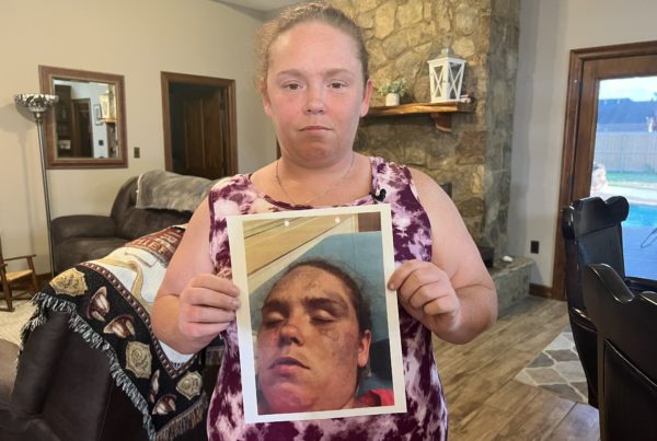 A person holds a picture of their severely bruised face.