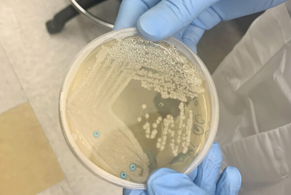CDC warns of potentially deadly fungus and the growing threat of antimicrobial resistance